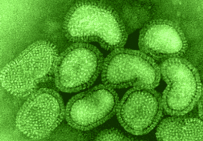 Virus A/H1N1 en el microscopio